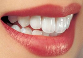 Răng giả cố định các loại