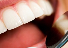 Các ưu điểm hiện đại và nổi trội trong phương pháp điều trị của Trung tâm cắm ghép Implant - Nha khoa Én Trắng