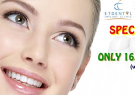 Giá ưu đãi đặc biệt hè 2017 - Chỉ 16 triệu đồng/răng implant hoàn tất