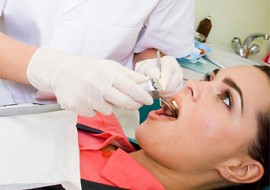 Các vật liệu trám răng hiện nay